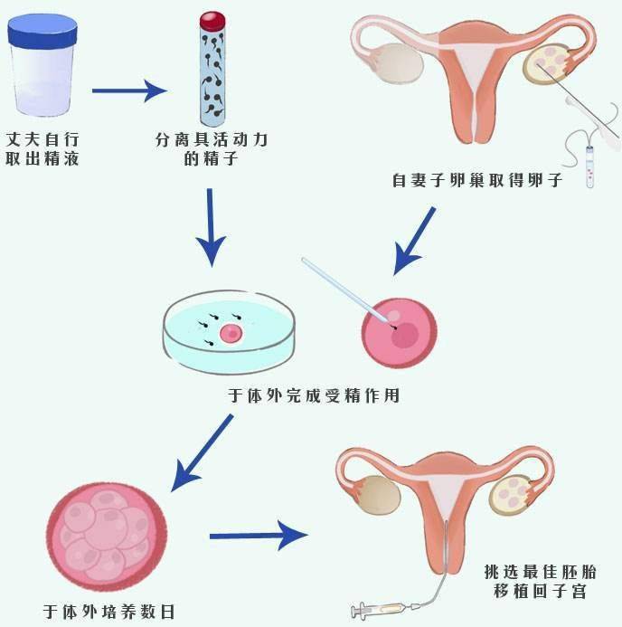 广东省人工受孕哪里医院最好